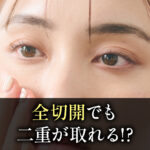 全切開_二重が取れる？
