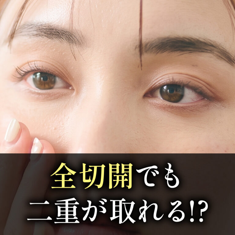 熊本で全切開二重の修正をお悩みの方へ。切開ラインが緩む原因と2つの修正法を医師が解説