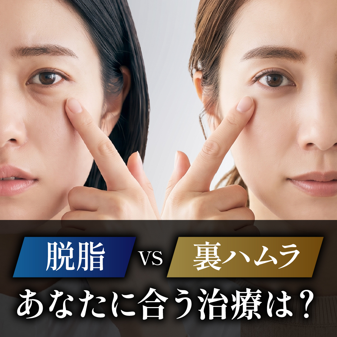 【熊本でクマ取り】脱脂と裏ハムラ法を徹底比較！あなたに合う治療はどっち？